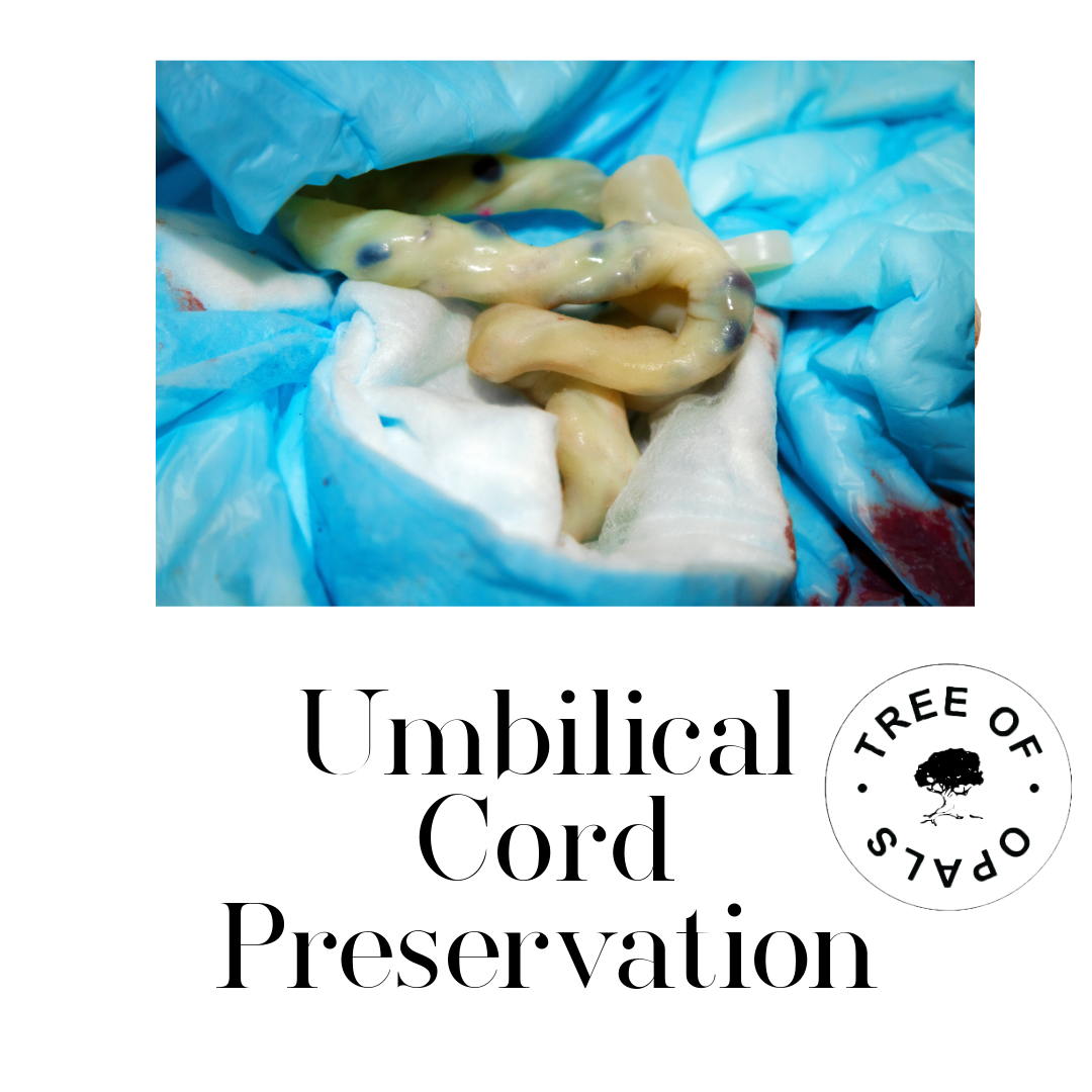 Umbilical Cord Preservation