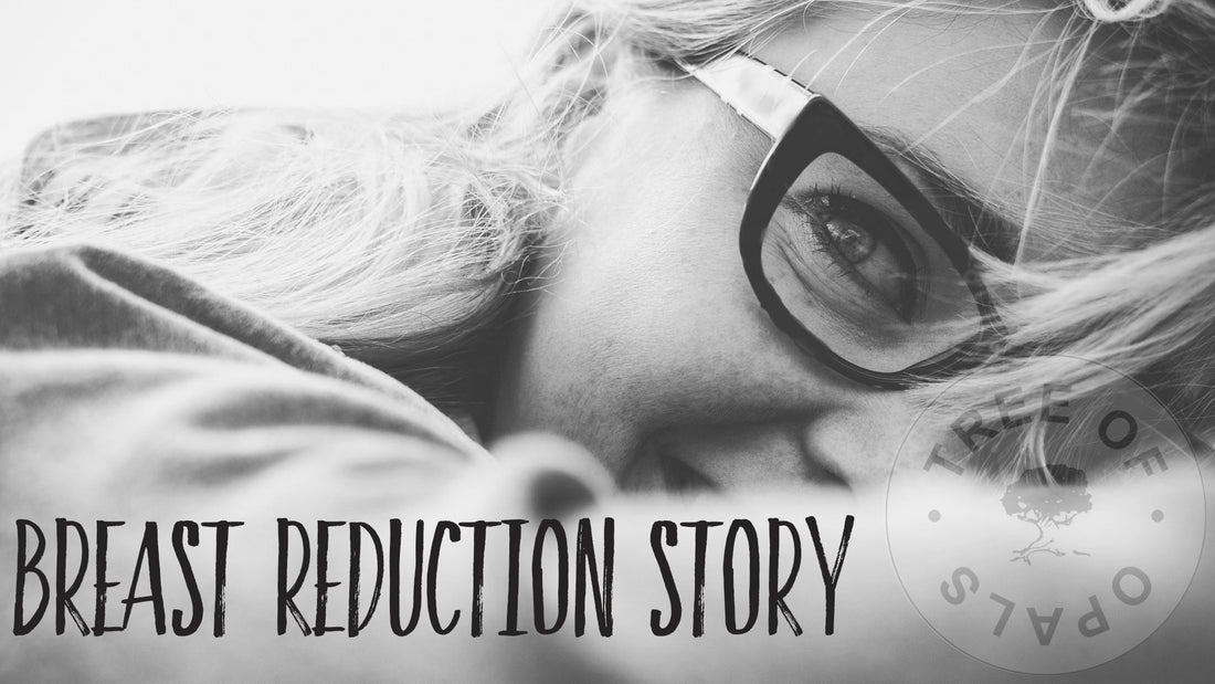 34JJ to 34D: Breast Reduction Story