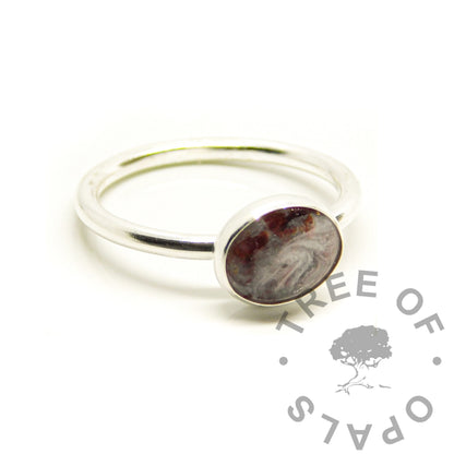 Umbilical Cord Ring